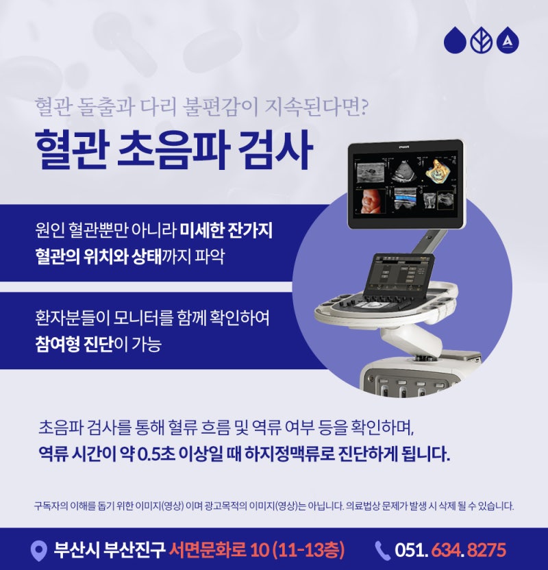 부산하지정맥시술, 수술 없이 하지정맥류 치료? 사진 4