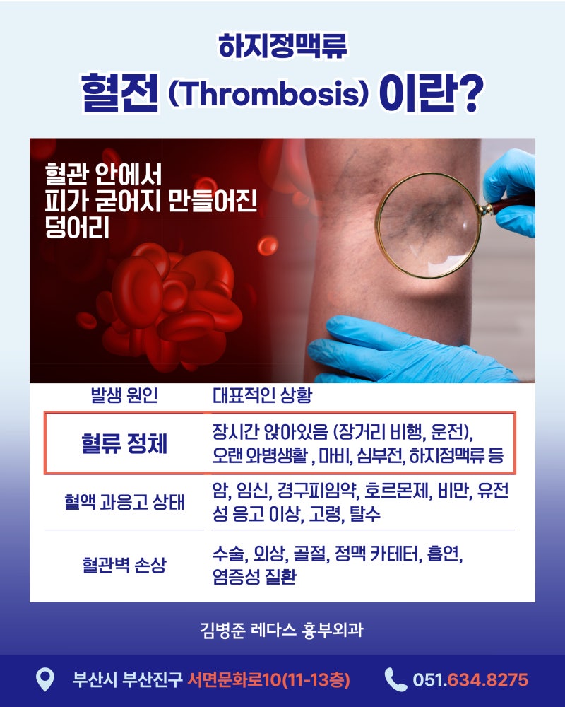 갑자기 붓는 한쪽 다리, 단순 부종일까 '혈전' 때문일까? 사진 3