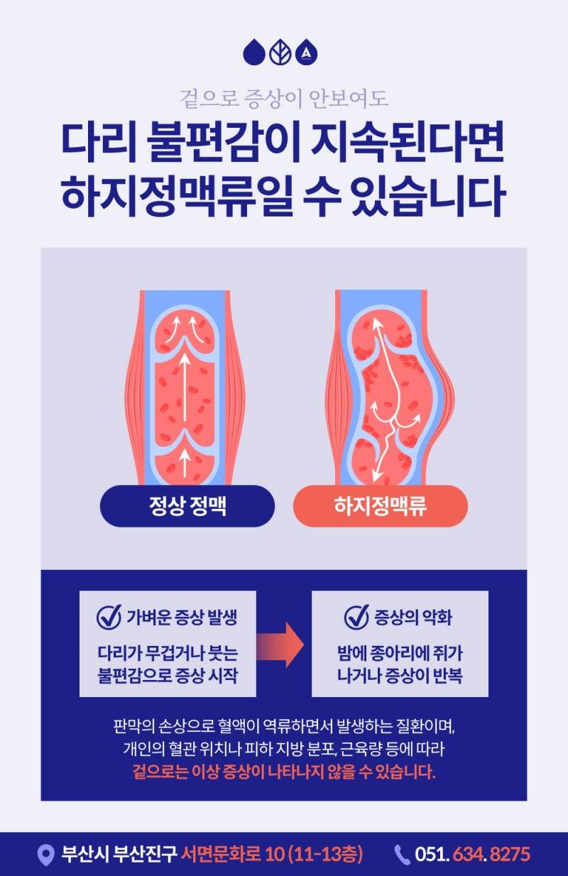 부산하지정맥류 증상 원인, 오래 서 있는 직업이라면 주목! 사진 3