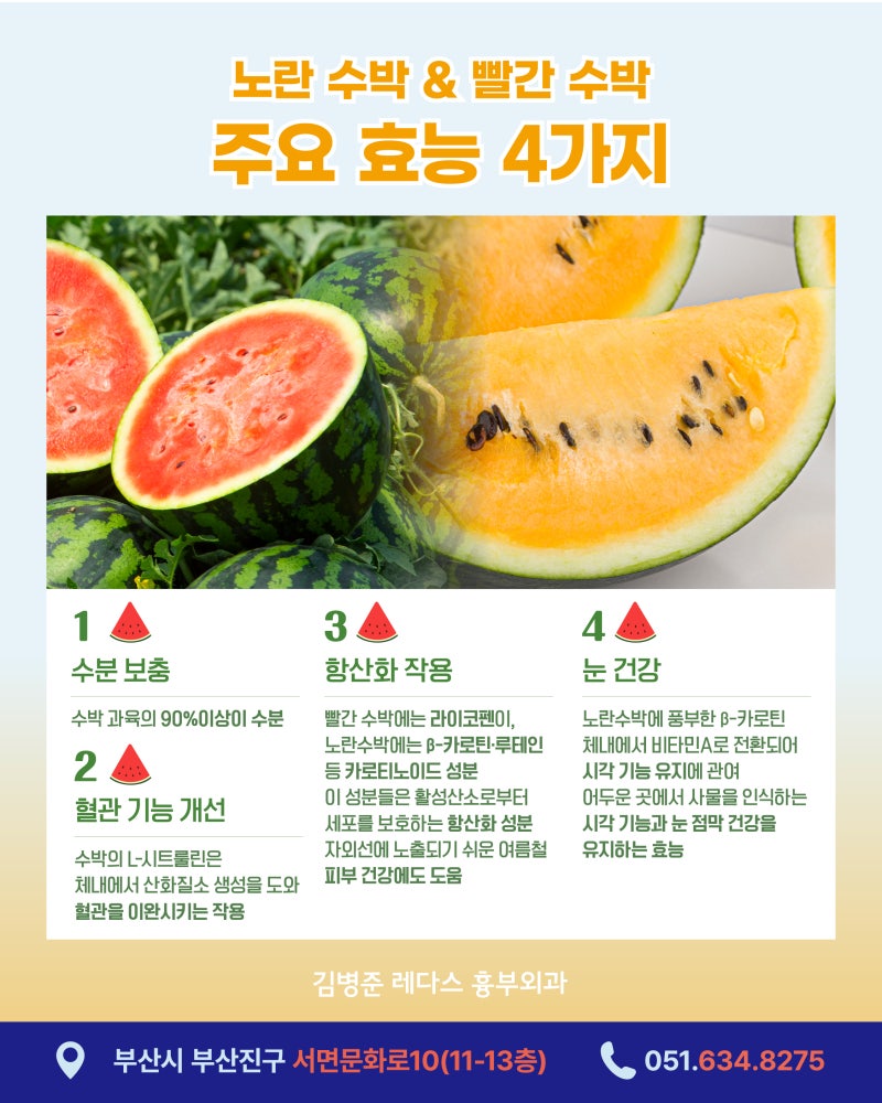 노란 수박vs 빨간 수박의 맛과 효능, 고르는 법 사진 2