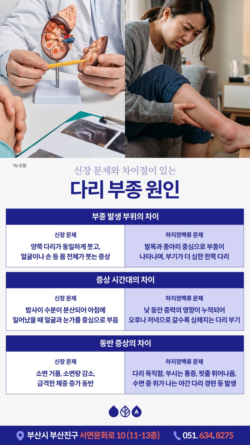 부산다리부종 원인, 신장 문제일까 혈관 문제일까? 구분하는 법 사진 5