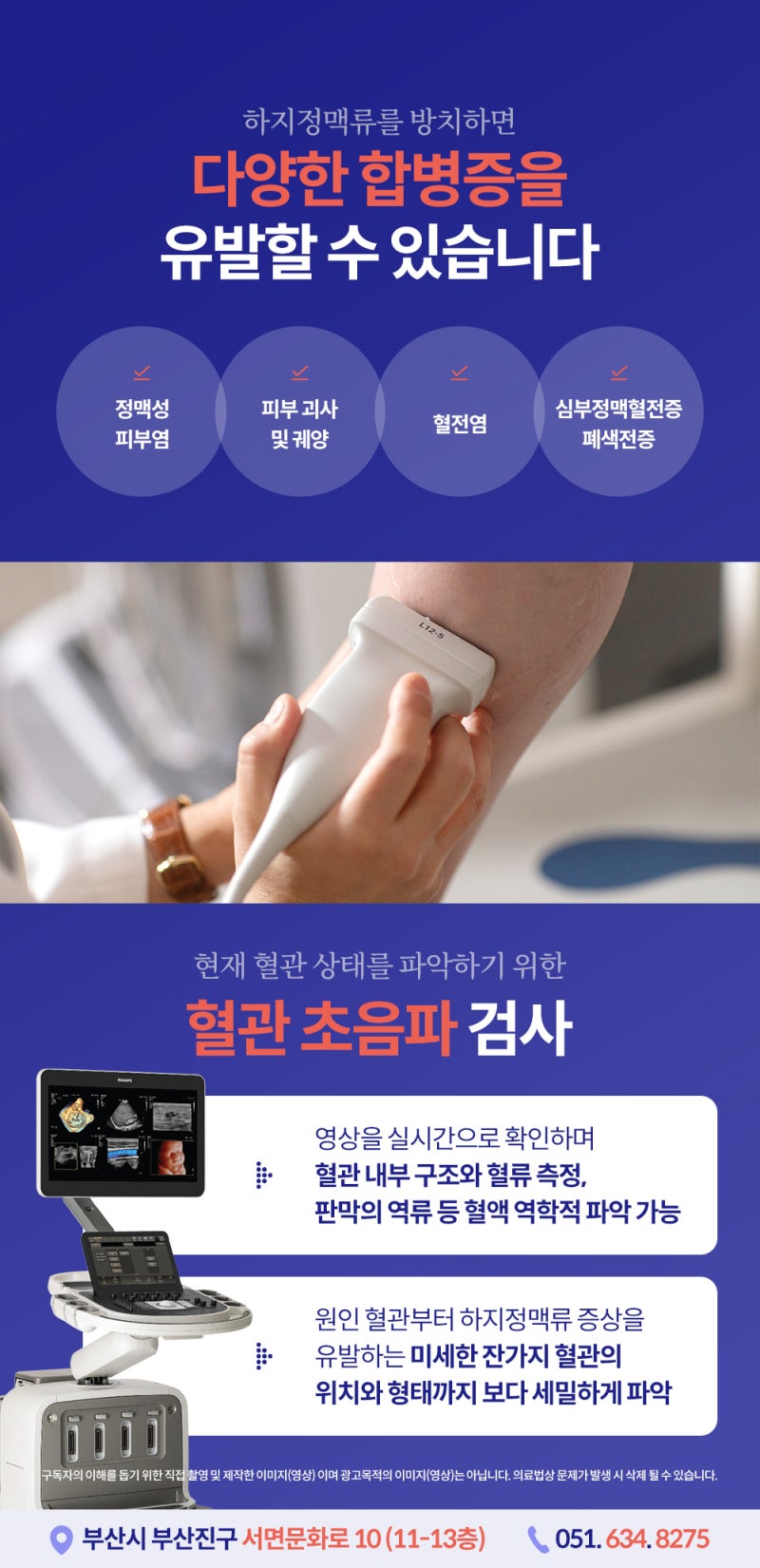 다리 실핏줄이 늘어나는 이유, 하지정맥류와 관련 있을까? 사진 6