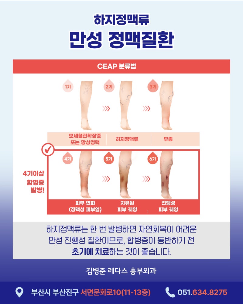 발목·정강이가 자꾸 가렵다면? 피부가 아닌 혈관 문제일 수 있습니다 사진 5