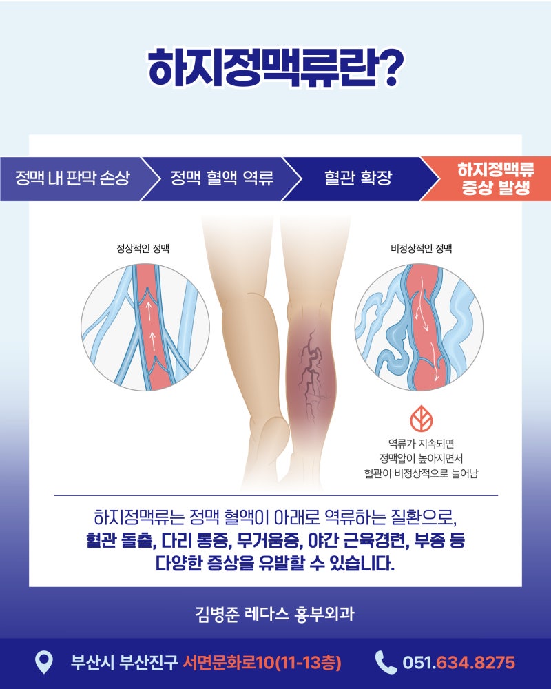 발목·정강이가 자꾸 가렵다면? 피부가 아닌 혈관 문제일 수 있습니다 사진 4